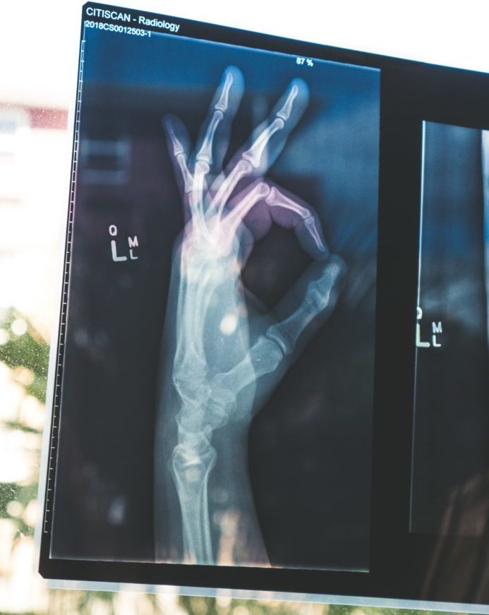 Photo of x-rayed hand giving OK sign
